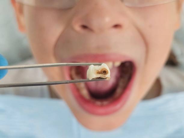 Best Holiday Emergency Dentist in Berryville, TX